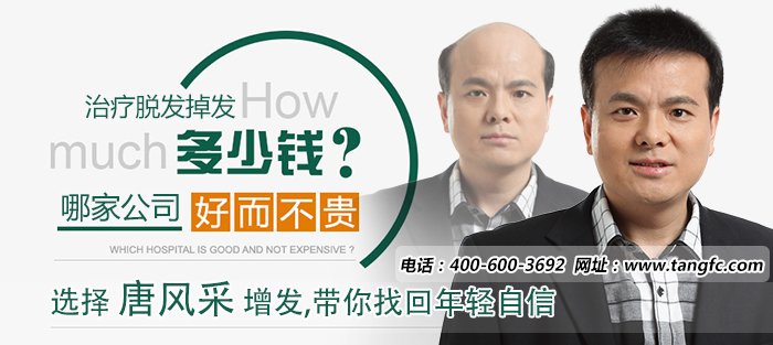無錫做假發,無錫假發 無錫做假發哪里好?怎樣的才能稱之為好假發?