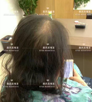 唐風(fēng)采就是這般任性 讓頭發(fā)一直好好的,唐風(fēng)采就是這般任性!