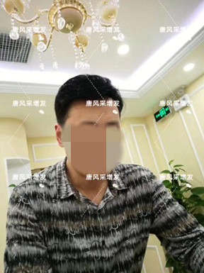 嘉興買隱形假發(fā)哪家好 嘉興買隱形假發(fā)哪家好?很多人選擇嗎?