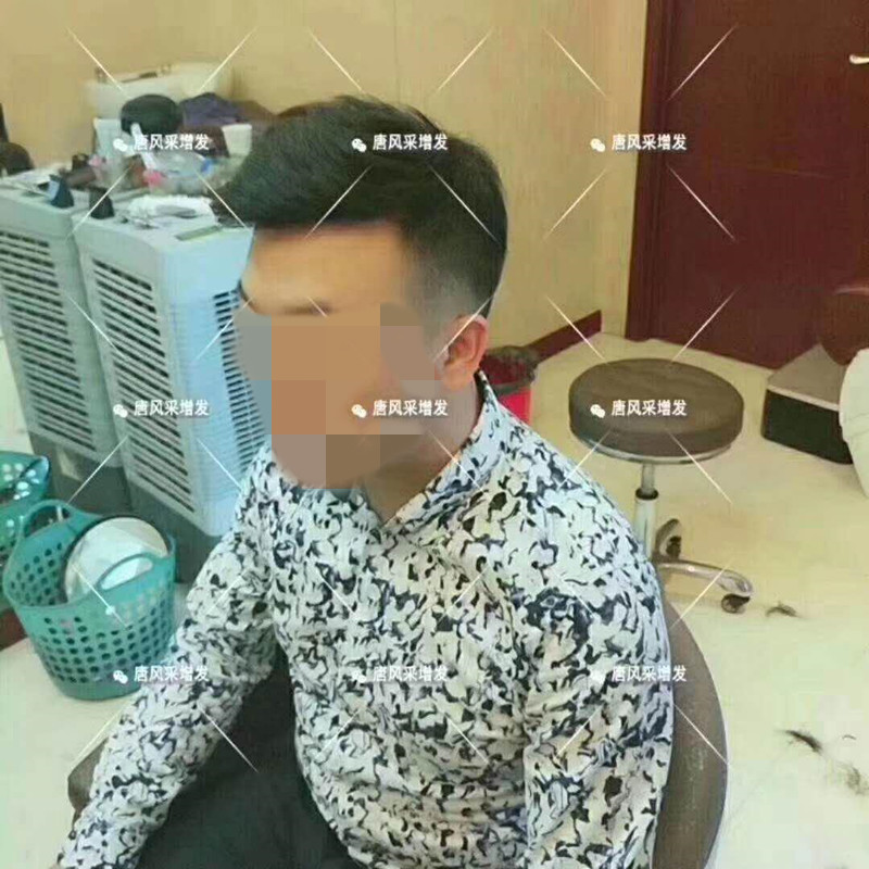 臺州真發假發 臺州真發假發哪有賣,夏天戴假發會悶熱嗎?