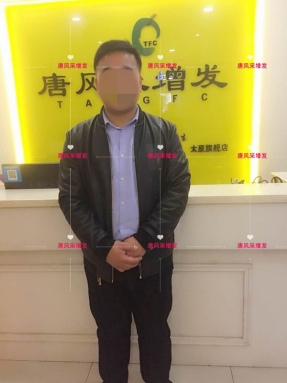 脫發 愿你脫發半生,歸來仍是少年!