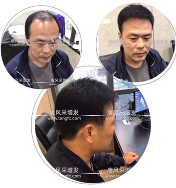 脫發(fā)的中年猥瑣男人 如何避免成為一個脫發(fā)的中年猥瑣男人?