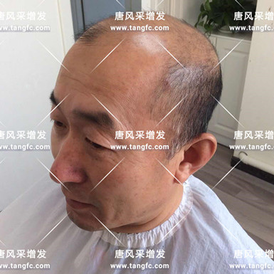 唐風采增發效果 耳聽為虛,眼見為實,唐風采老客戶增發效果實錄!