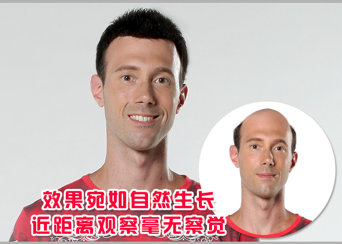 男士假發套價格 男士假發套價格貴嗎?買多少錢的效果看起來才逼真?