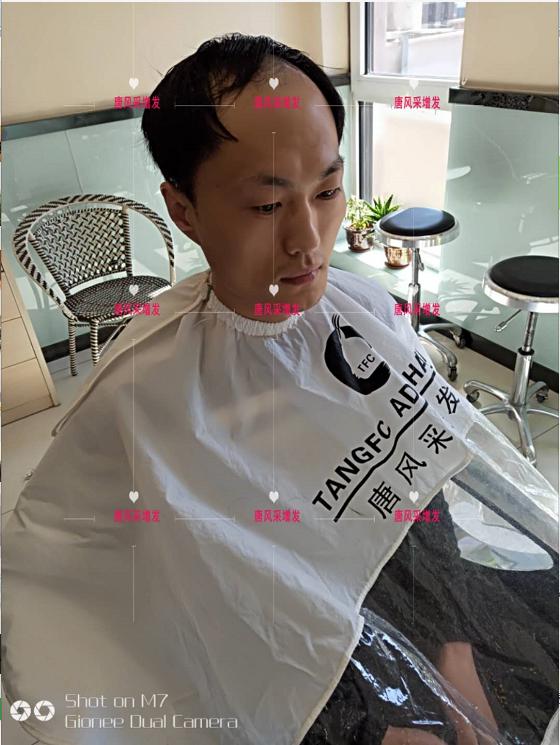 男士假發套價格 男士假發套價格貴嗎?買多少錢的效果看起來才逼真?