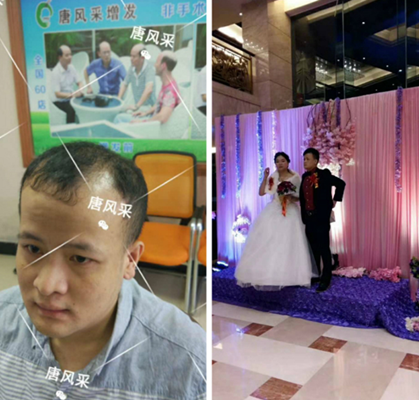 脫單,脫發(fā) 我還沒有脫單,怎么就脫發(fā)了呢?