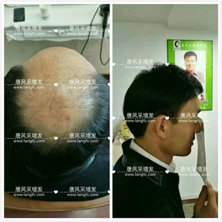 男款假發品牌哪家好 男款假發品牌哪家好,有用過唐風采的嗎?