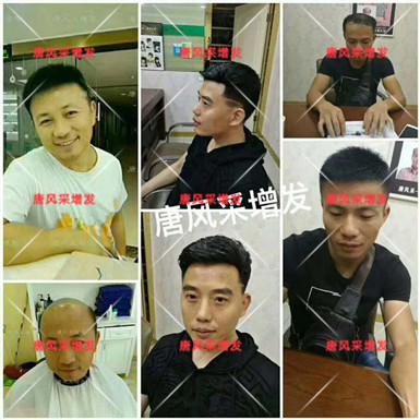 男款假發品牌哪家好 男款假發品牌哪家好,有用過唐風采的嗎?