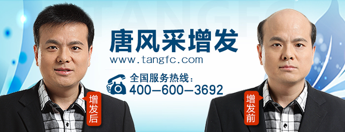 嘉興男士補發哪里好？哪家才經受得住時間的考驗？