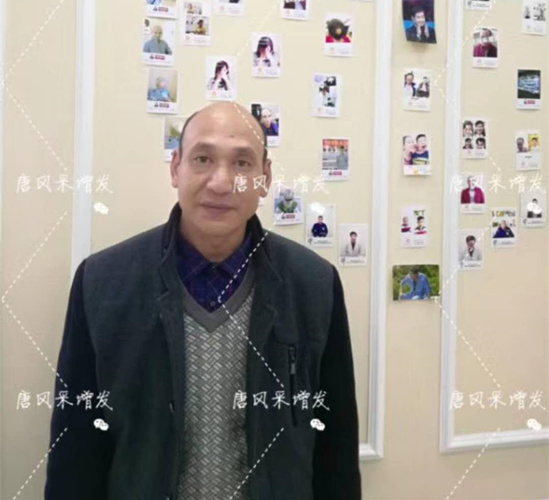 光頭 藥神 《我不是藥神》火了,山爭哥哥光頭變“藥神”成熱門話題!