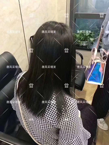 西寧織發(fā)補(bǔ)發(fā)需要多少錢,哪家補(bǔ)發(fā)技術(shù)好？