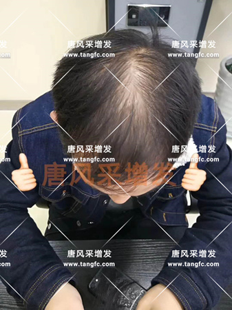臺州哪里有賣假發的 臺州哪里有賣假發的,逼真效果怎么樣?