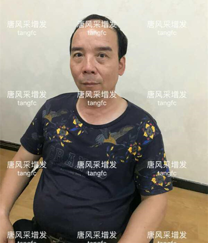 朋友碰面不敢認，直擊發友增發后的真實改變！
