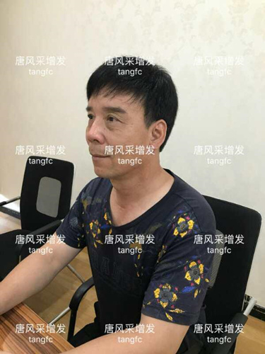 朋友碰面不敢認，直擊發友增發后的真實改變！