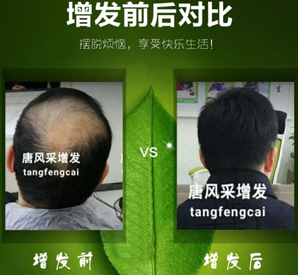 嘉興織發補發哪家好？發友們都“發”現了這家！