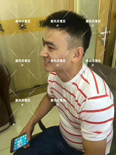 西寧織發補發哪家好，真的能改變我的脫發形象嗎？ 