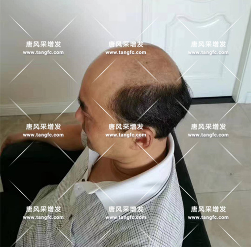 老年短假發 老年短假發全真發的好嗎? 主要是用來遮白發的!
