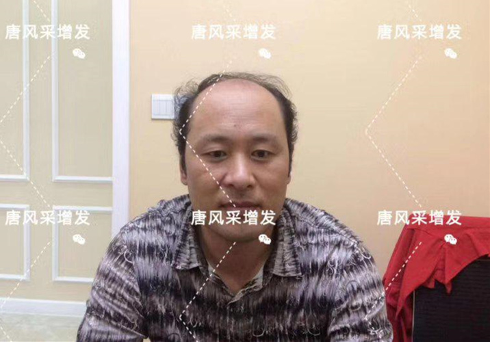嘉興假發(fā)片定制哪家好 嘉興假發(fā)片定制哪家好?唐風(fēng)采增發(fā)成了首選!