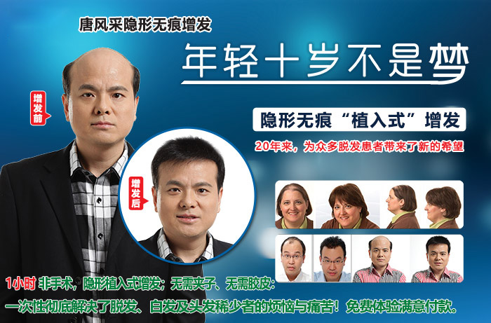 嘉興假發(fā)片定制哪家好 嘉興假發(fā)片定制哪家好?唐風(fēng)采增發(fā)成了首選!