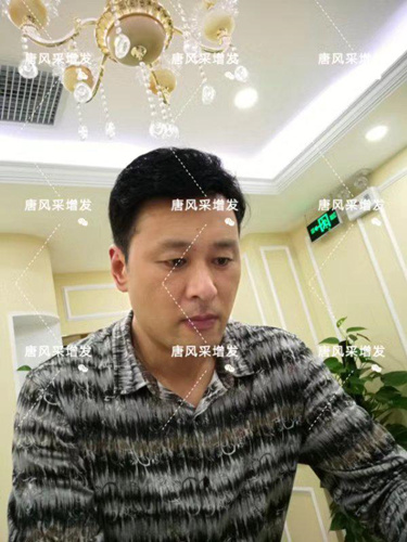 嘉興假發(fā)片定制哪家好 嘉興假發(fā)片定制哪家好?唐風(fēng)采增發(fā)成了首選!