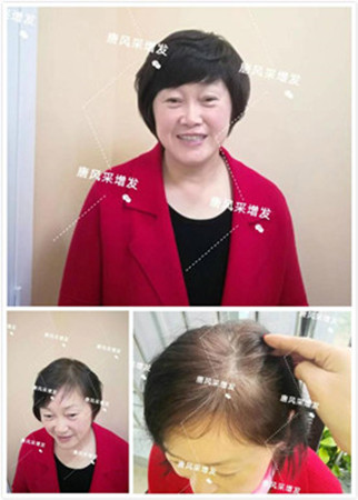 西寧假發專賣店哪家好 西寧假發專賣店哪家好,無痕真發假發跟一般發套有區別嗎