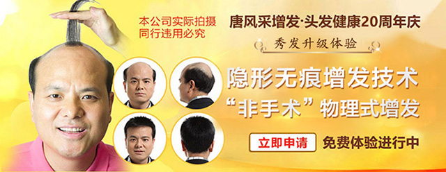 西寧買隱形假發哪家好? 隱形假發