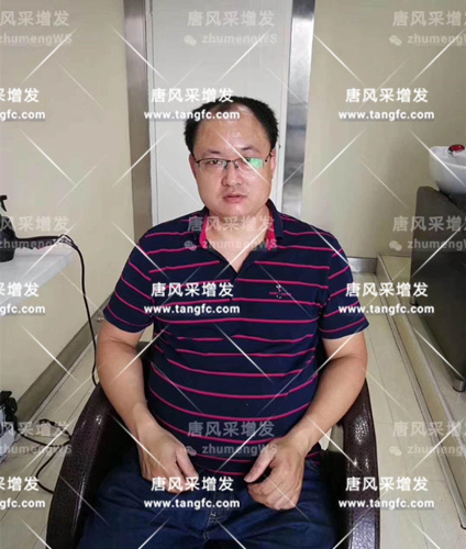 西寧做假發 西寧店客戶案例范先生
