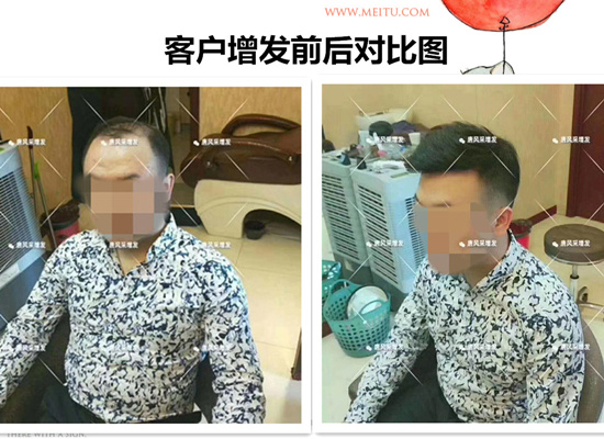 嘉興織發(fā) 客戶案例圖片