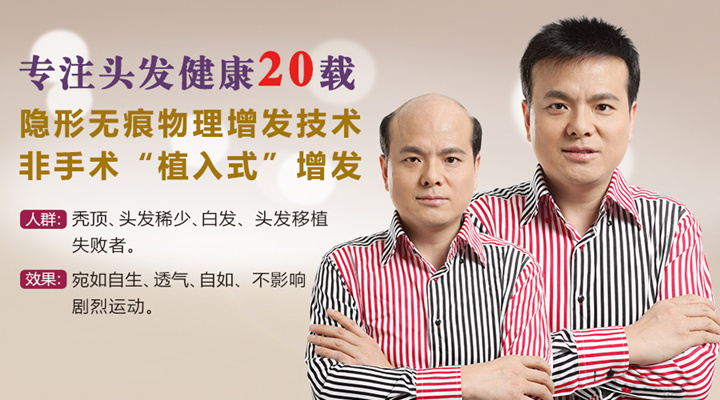 西寧織發補發機構哪家好? 西寧織發補發機構哪家好?肯定唐風采增發