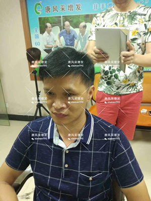 西寧假發店 藍先生增發后