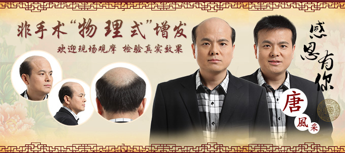 西寧哪里有織發補發? 唐風采增發