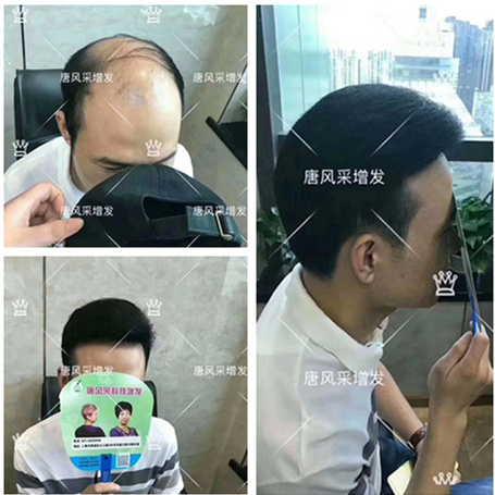 補發增發