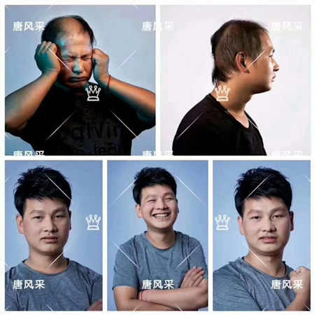 補發增發
