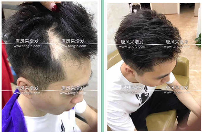 增發后的效果