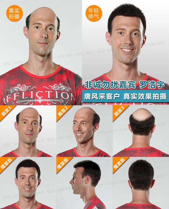 如何白發變黑 唐風采增發