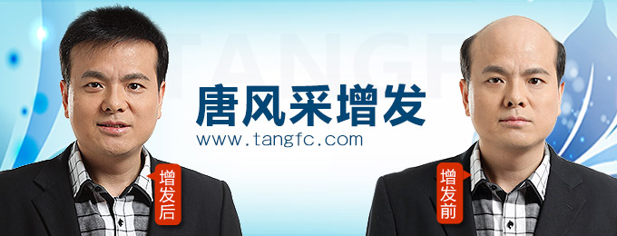 西寧哪里有假發專賣店 唐風采增發