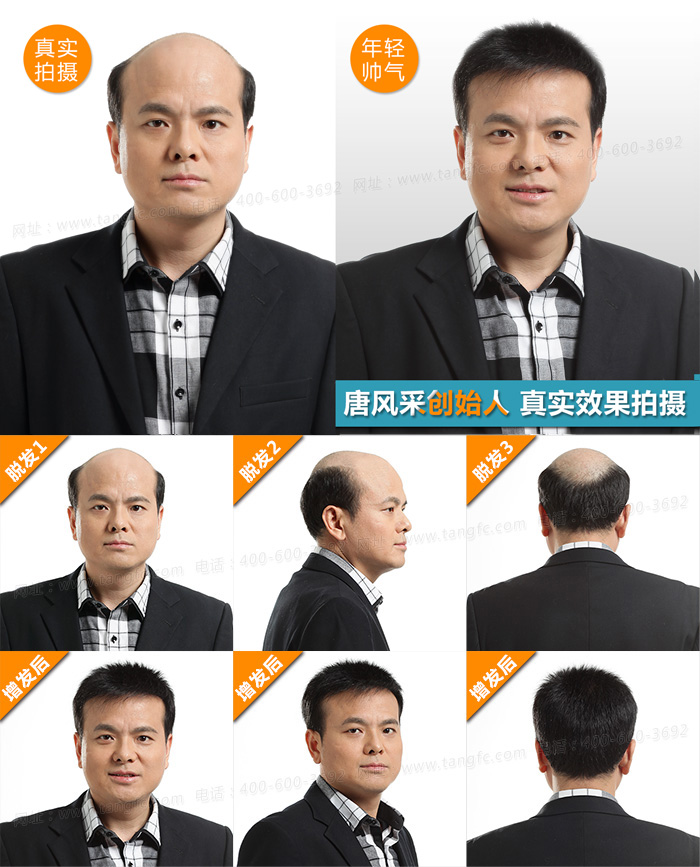 西寧哪里有賣假發(fā)的 西寧哪里有賣假發(fā)的,什么品牌的假發(fā)性價比高呢?
