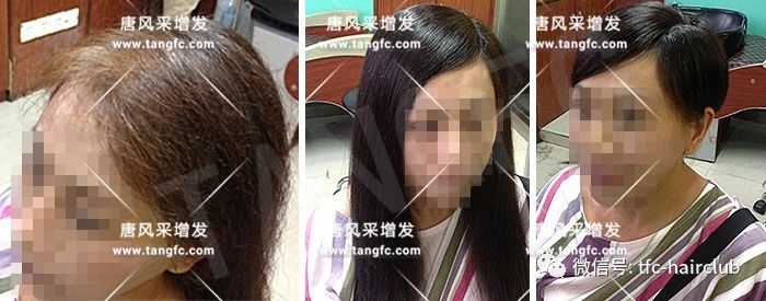 西寧哪里有賣假發(fā)的 唐風采增發(fā)案例