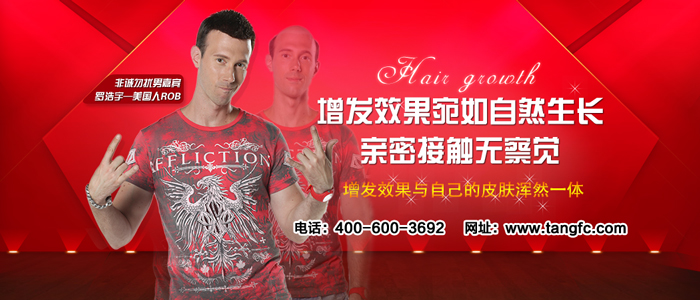 西寧哪里有賣假發(fā)的 唐風采增發(fā)