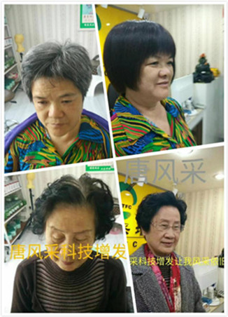 白發變黑方法介紹 增發