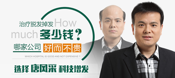 西寧哪有買假發(fā)的 唐風(fēng)采織發(fā)補發(fā)