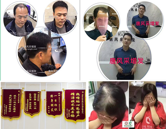 頭發少發型,天生發量稀少 唐風采客戶案例