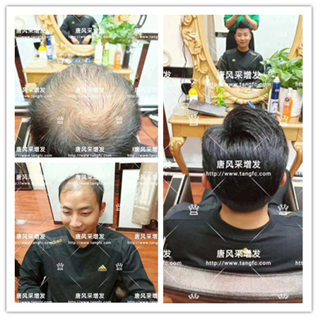 唐風采增發