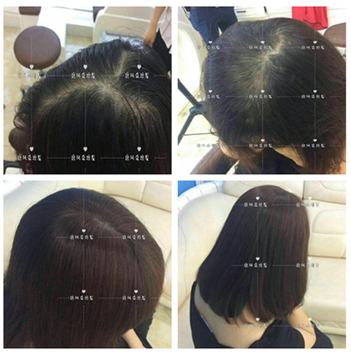 合肥好的假發(fā) 唐風(fēng)采增發(fā)客戶案例