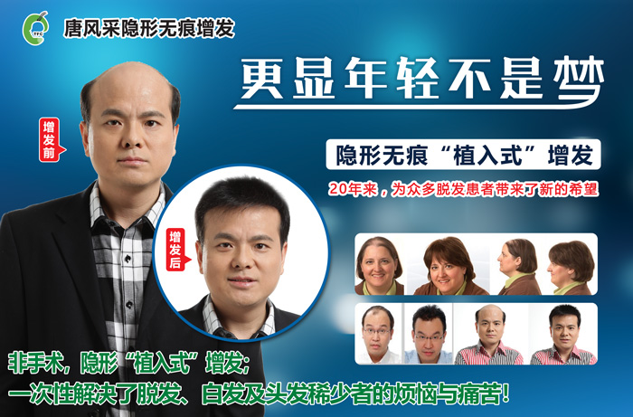 男士假發套價格 唐風采增發