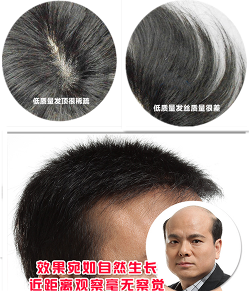 哈爾濱高檔假發 假發對比圖