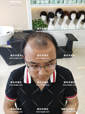 哈爾濱假發 唐風采客戶