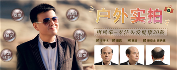 哈爾濱哪里可以用自己的頭發做假發 唐風采織發補發