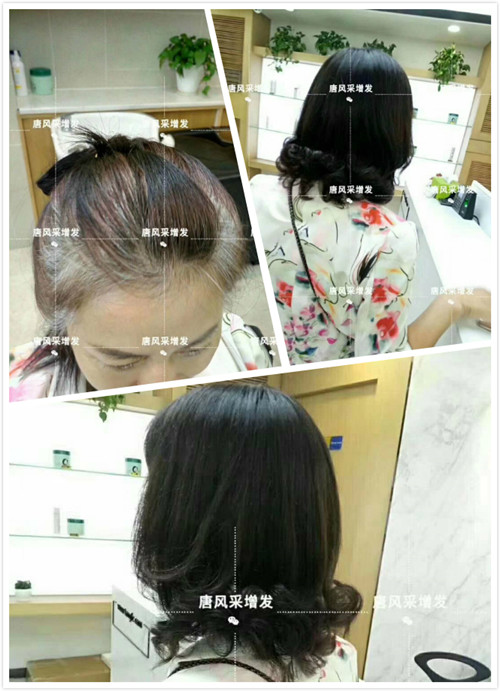 哈爾濱哪里可以用自己的頭發做假發? 客戶案例分享