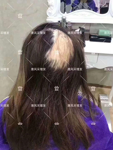 福州哪里賣女士假發 客戶案例